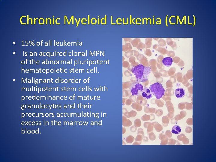 Chronic Myeloid Leukemia (CML) • 15% of all leukemia • is an acquired clonal