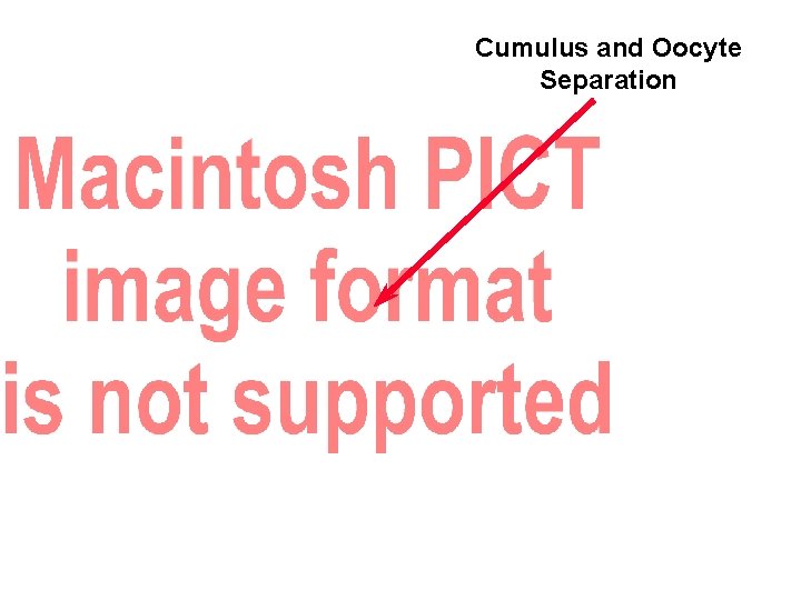 Cumulus and Oocyte Separation 