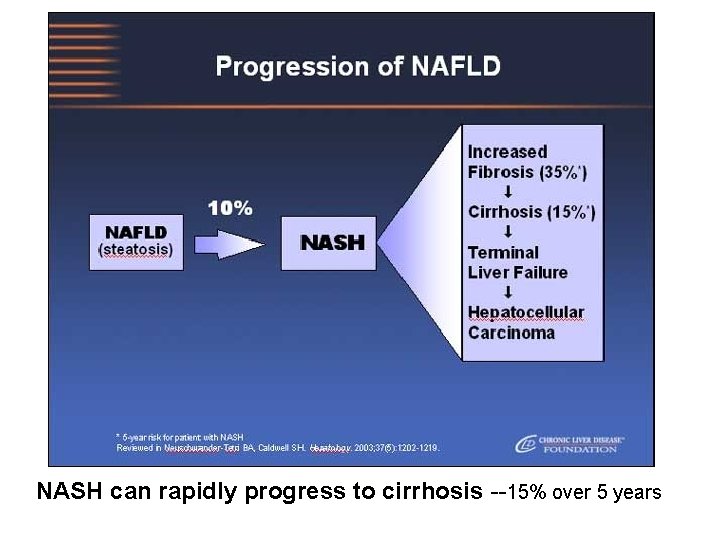 NASH can rapidly progress to cirrhosis --15% over 5 years 