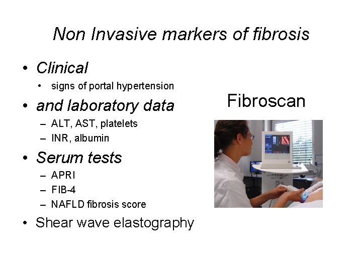 Non Invasive markers of fibrosis • Clinical • signs of portal hypertension • and