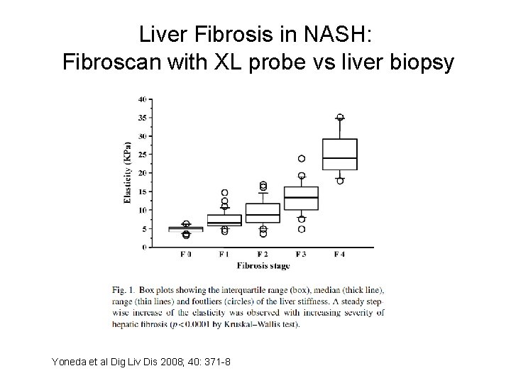 Liver Fibrosis in NASH: Fibroscan with XL probe vs liver biopsy Yoneda et al