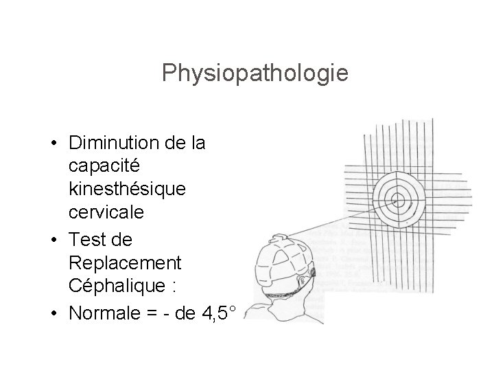 Physiopathologie • Diminution de la capacité kinesthésique cervicale • Test de Replacement Céphalique :