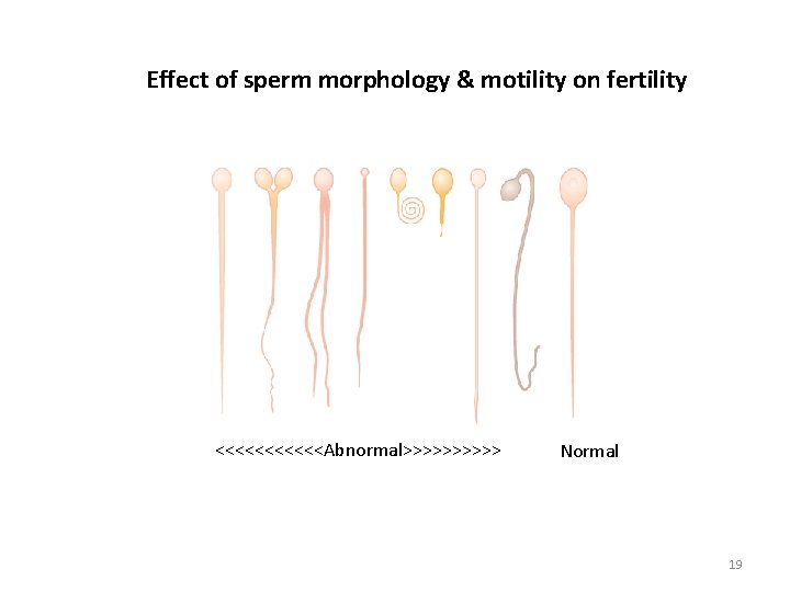 Effect of sperm morphology & motility on fertility <<<<<<Abnormal>>>>> Normal 19 