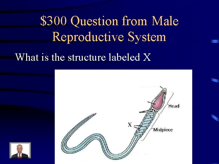 $300 Question from Male Reproductive System What is the structure labeled X $300 Question from Male Reproductive System What is the structure labeled X