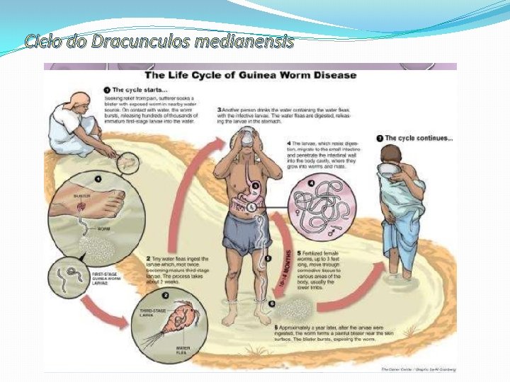 Ciclo do Dracunculos medianensis 