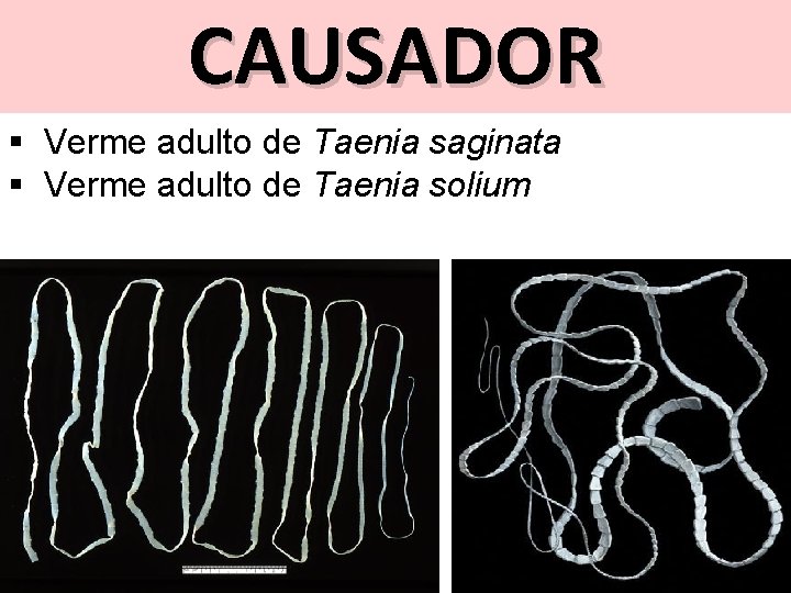 CAUSADOR § Verme adulto de Taenia saginata § Verme adulto de Taenia solium 