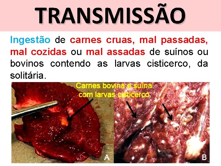 TRANSMISSÃO Ingestão de carnes cruas, mal passadas, mal cozidas ou mal assadas de suínos