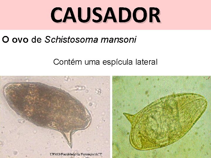 CAUSADOR O ovo de Schistosoma mansoni Contém uma espícula lateral 