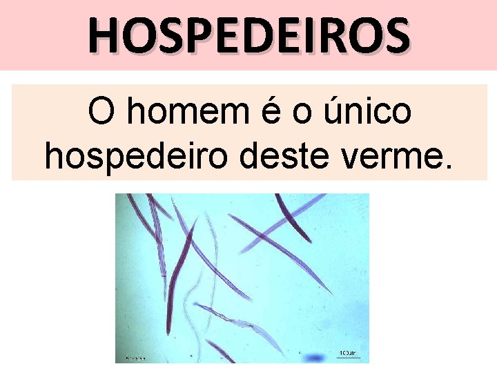 HOSPEDEIROS O homem é o único hospedeiro deste verme. 