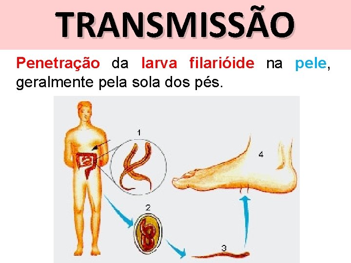 TRANSMISSÃO Penetração da larva filarióide na pele, geralmente pela sola dos pés. 