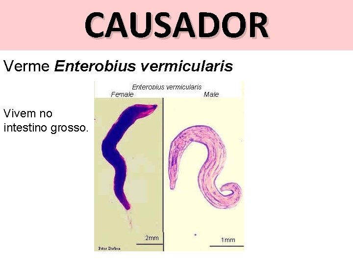CAUSADOR Verme Enterobius vermicularis Vivem no intestino grosso. 