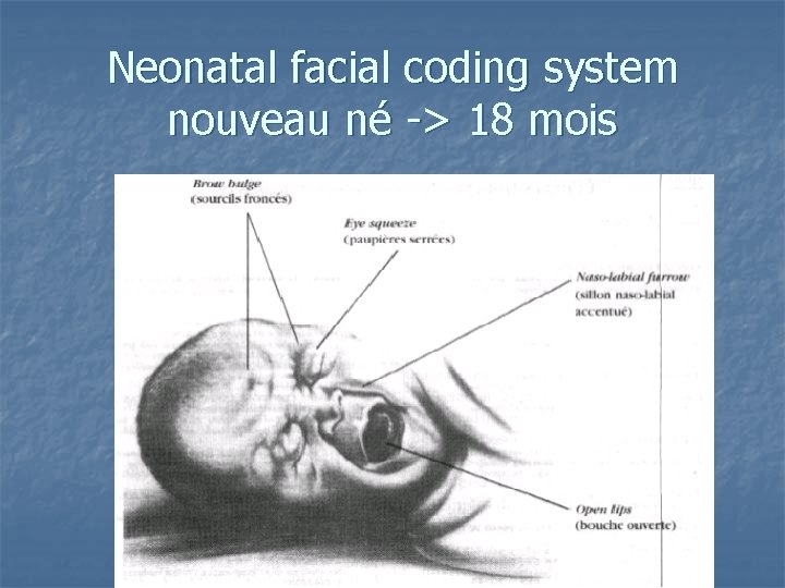 Neonatal facial coding system nouveau né -> 18 mois 