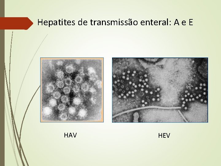 Hepatites de transmissão enteral: A e E HAV HEV Hepatites de transmissão enteral: A e E HAV HEV
