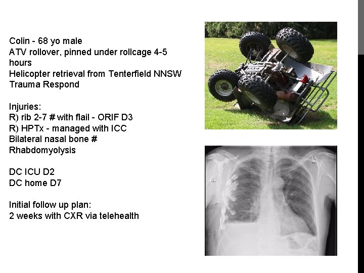 Colin - 68 yo male ATV rollover, pinned under rollcage 4 -5 hours Helicopter