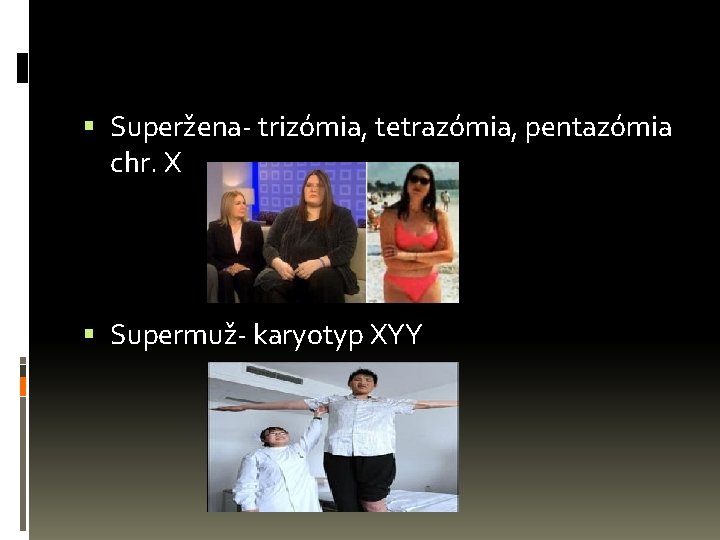  Superžena- trizómia, tetrazómia, pentazómia chr. X Supermuž- karyotyp XYY 