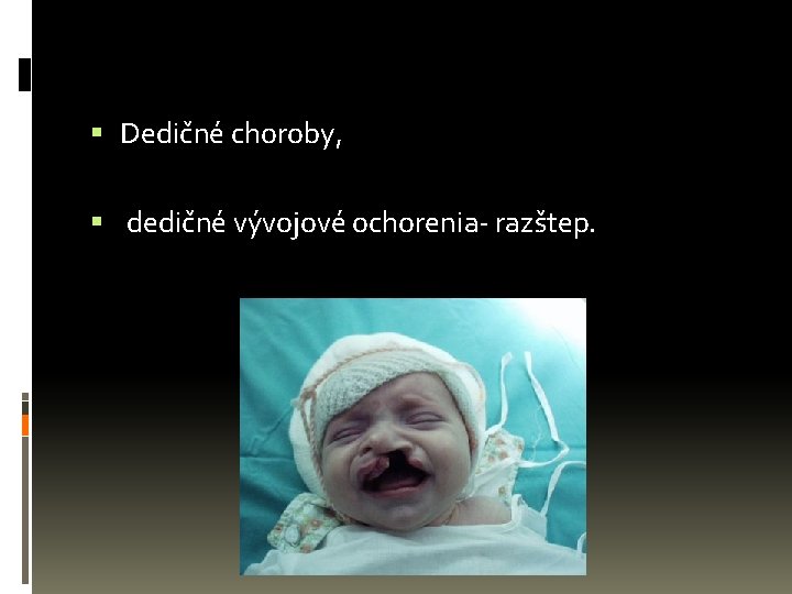  Dedičné choroby, dedičné vývojové ochorenia- razštep. 