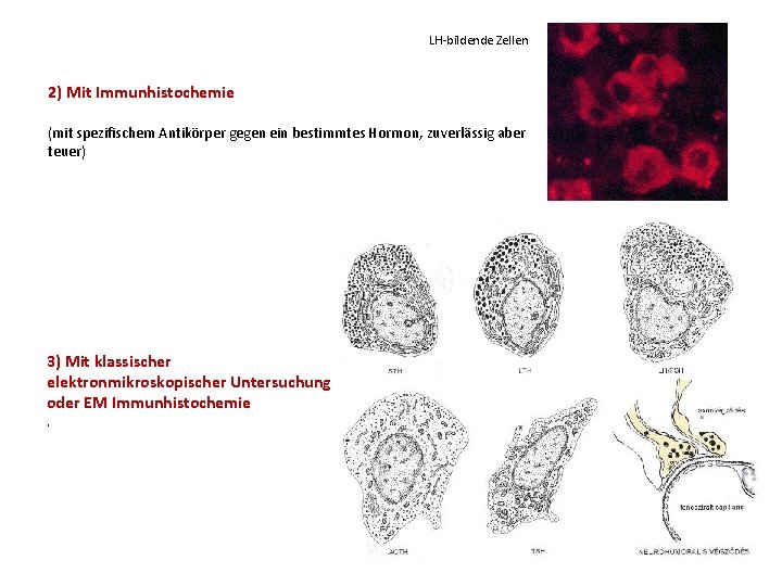 LH-bildende Zellen 2) Mit Immunhistochemie (mit spezifischem Antikörper gegen ein bestimmtes Hormon, zuverlässig aber