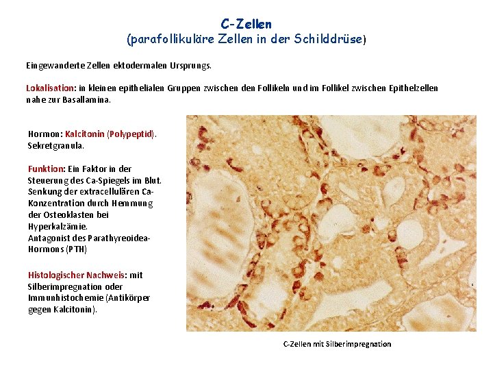 C-Zellen (parafollikuläre Zellen in der Schilddrüse) Eingewanderte Zellen ektodermalen Ursprungs. Lokalisation: in kleinen epithelialen