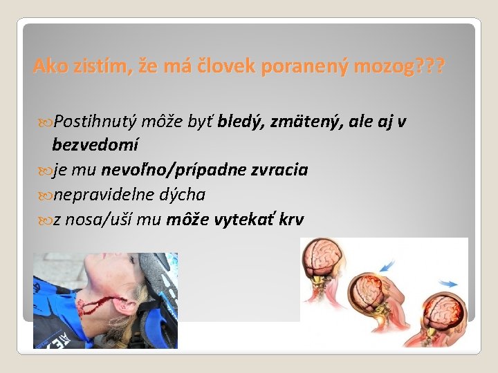 Ako zistím, že má človek poranený mozog? ? ? Postihnutý môže byť bledý, zmätený,