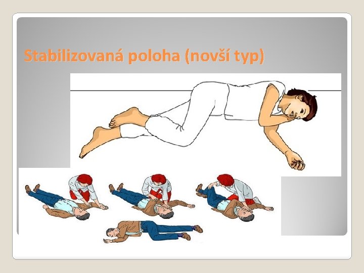 Stabilizovaná poloha (novší typ) 