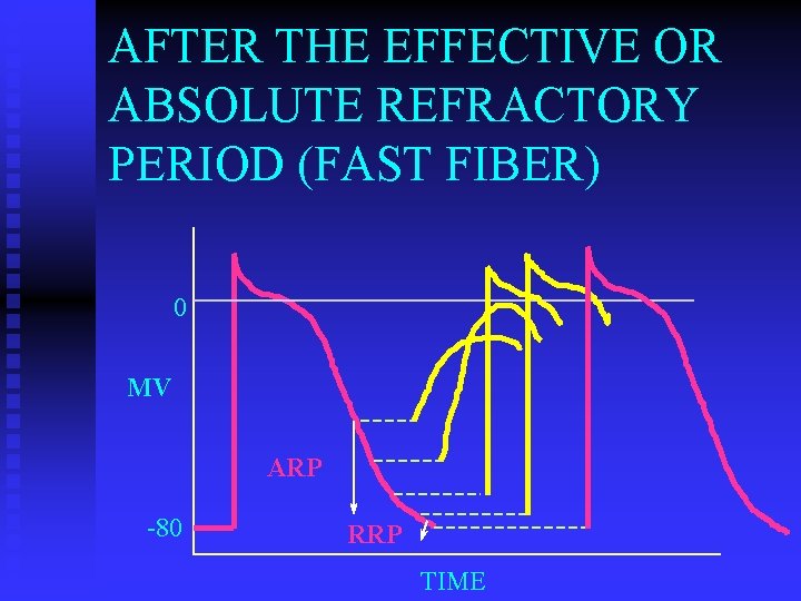 AFTER THE EFFECTIVE OR ABSOLUTE REFRACTORY PERIOD (FAST FIBER) 0 MV ARP -80 RRP