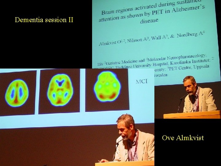 Dementia session II Ove Almkvist 