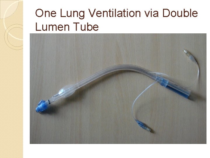 One Lung Ventilation via Double Lumen Tube 