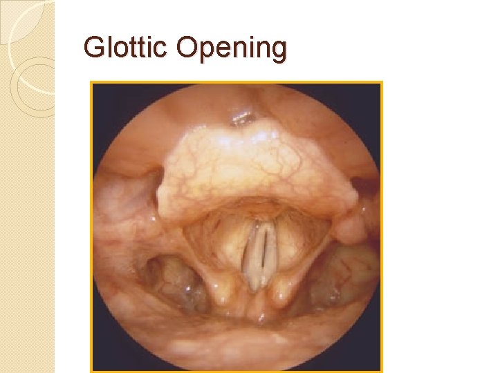 Glottic Opening 