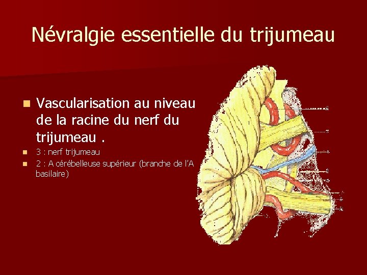 Névralgie essentielle du trijumeau n n n Vascularisation au niveau de la racine du