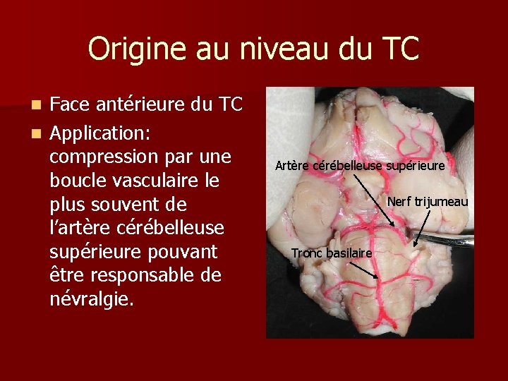 Origine au niveau du TC Face antérieure du TC n Application: compression par une