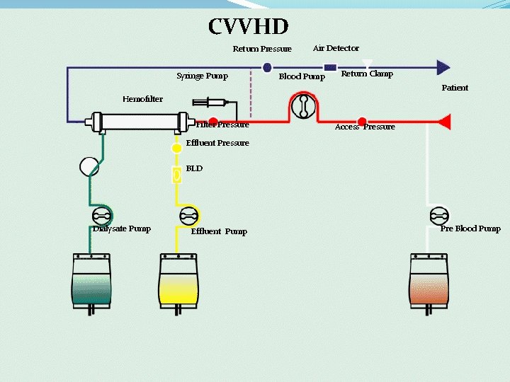 CVVHD Return Pressure Syringe Pump Air Detector Blood Pump Return Clamp Patient Hemofilter Filter CVVHD Return Pressure Syringe Pump Air Detector Blood Pump Return Clamp Patient Hemofilter Filter