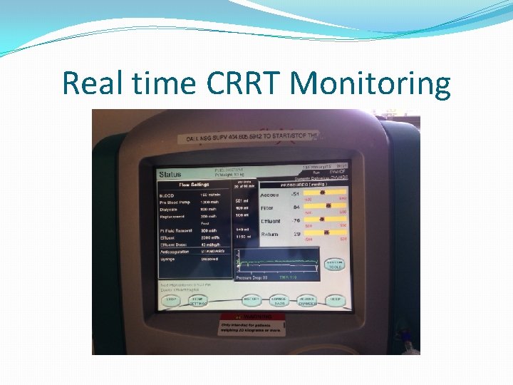 Real time CRRT Monitoring Real time CRRT Monitoring