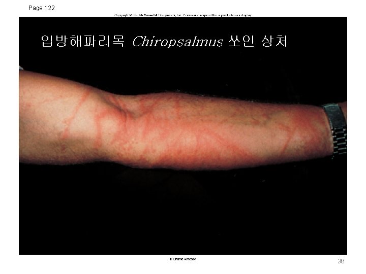 Page 122 입방해파리목 Chiropsalmus 쏘인 상처 38 