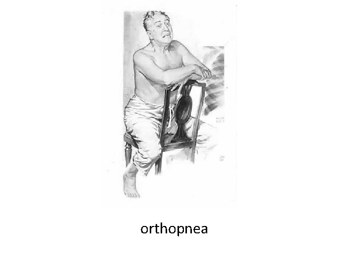 orthopnea 