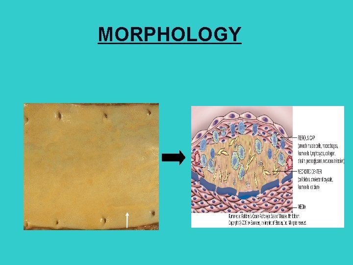 MORPHOLOGY 