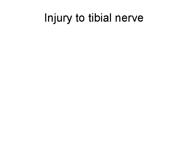 Injury to tibial nerve 