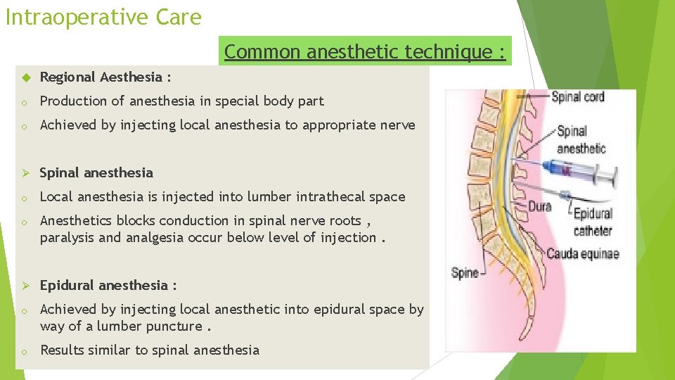 Intraoperative Care Common anesthetic technique : Regional Aesthesia : o Production of anesthesia in