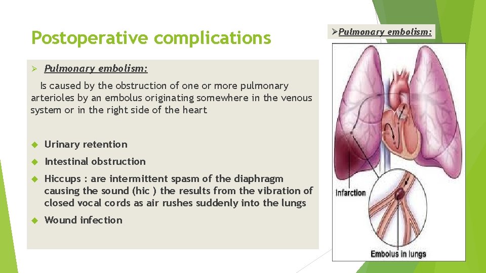 Postoperative complications Ø Pulmonary embolism: Is caused by the obstruction of one or more