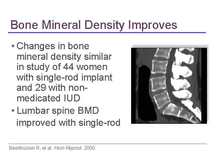 Bone Mineral Density Improves • Changes in bone mineral density similar in study of