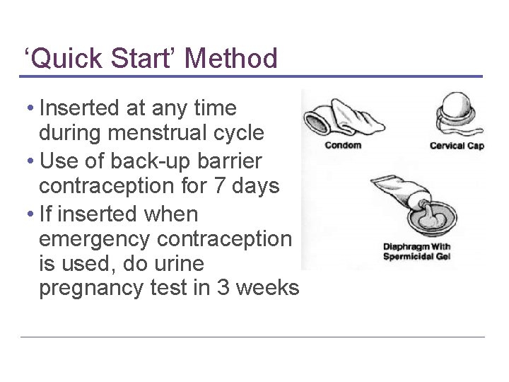 ‘Quick Start’ Method • Inserted at any time during menstrual cycle • Use of