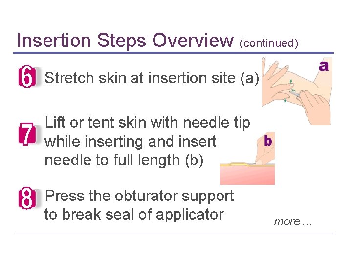 Insertion Steps Overview (continued) Stretch skin at insertion site (a) Lift or tent skin