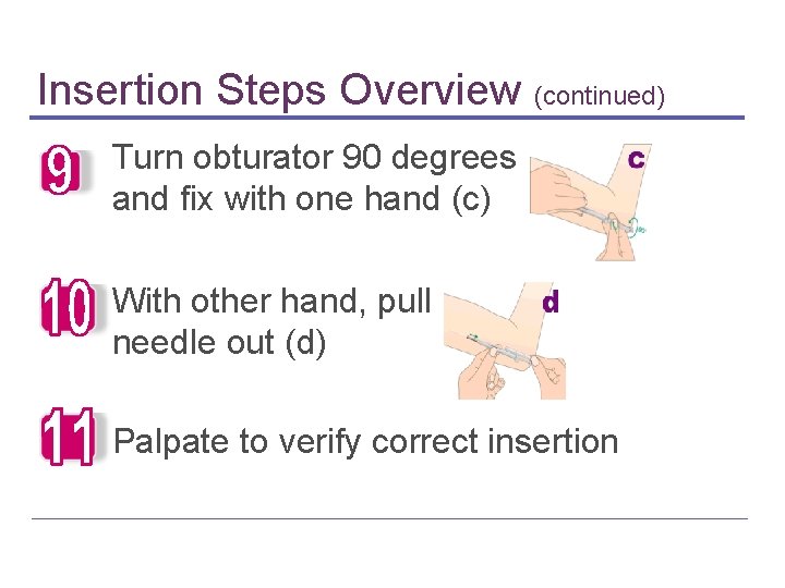 Insertion Steps Overview (continued) Turn obturator 90 degrees and fix with one hand (c)