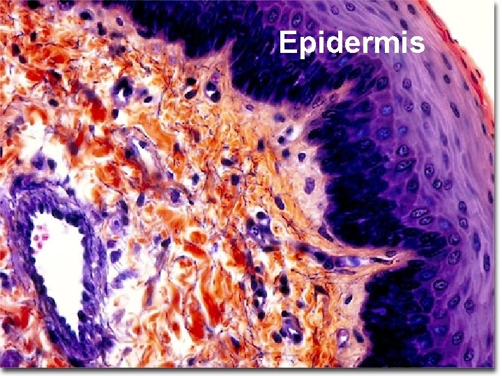 Epidermis 