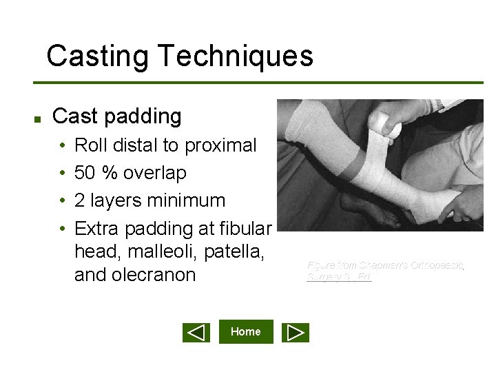 Casting Techniques n Cast padding • • Roll distal to proximal 50 % overlap