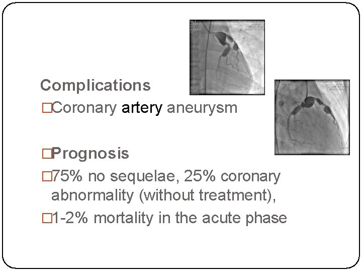 Complications �Coronary artery aneurysm �Prognosis � 75% no sequelae, 25% coronary abnormality (without treatment),