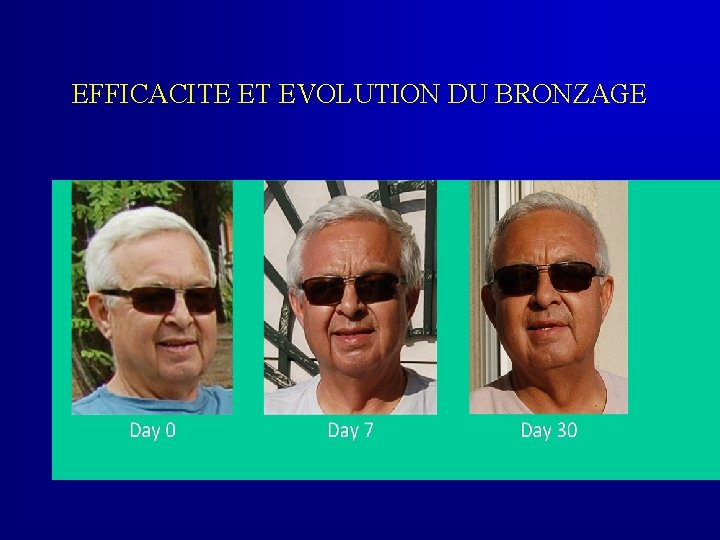 EFFICACITE ET EVOLUTION DU BRONZAGE 