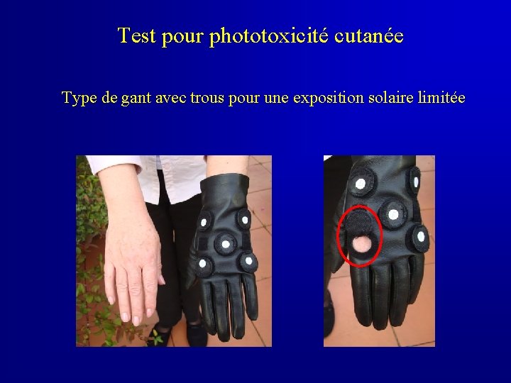 Test pour phototoxicité cutanée Type de gant avec trous pour une exposition solaire limitée