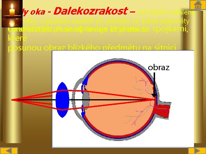 Vady oka - Dalekozrakost – vidí dobře vzdálené předměty, nedokáže zaostřit při pohledu na