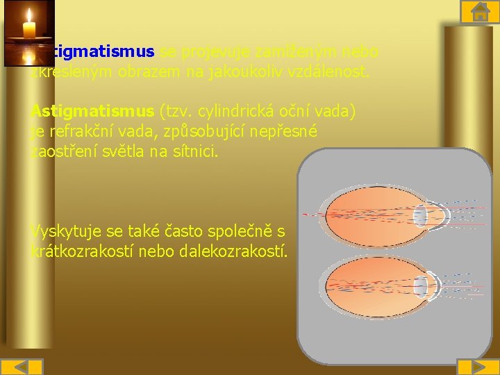 Astigmatismus se projevuje zamlženým nebo zkresleným obrazem na jakoukoliv vzdálenost. Astigmatismus (tzv. cylindrická oční
