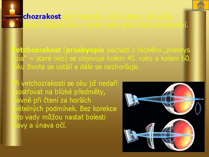 Vetchozrakost není klasickou oční vadou, ale spíše projevem stárnutí oka a ztráty jeho pružnosti